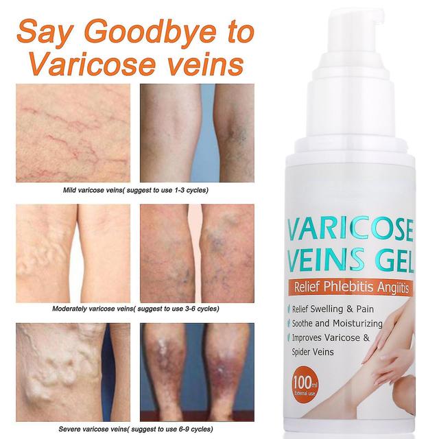 Varicose Veins Gel, Veincare Moderate Gel, Spider Vein Cream For Legs, Improve Blood Circulation, Improve Blood Circulation 3pcs on Productcaster.