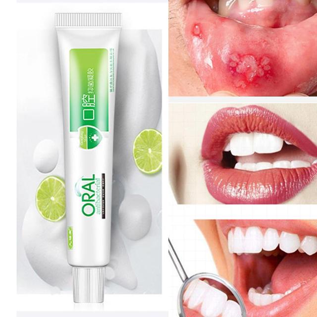 20g Gel De Soins Bucco-Dentaires Améliorer La Capacité De Réparation Mini Plantes Extraits Oral Antibactérien Gel Pour Dentaire on Productcaster.