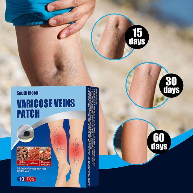 South Moon Vein Pills Posted Vein Vascular Nodules Tendon Pain Soreness Discomfort Soothing Tendon Patch on Productcaster.