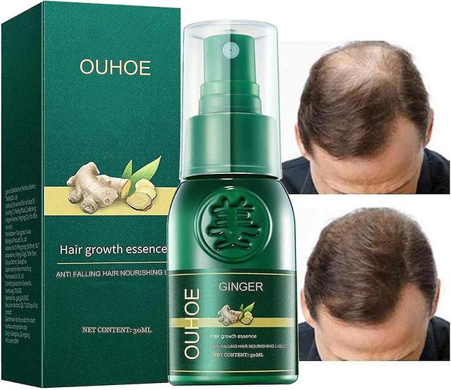 Ginger Sprout Oil,30ml Ginseng Hair Growth Spray - Mist Grows Thicker, Longer Hair, Accelerates In Men And Women_Feb 1 pcs on Productcaster.