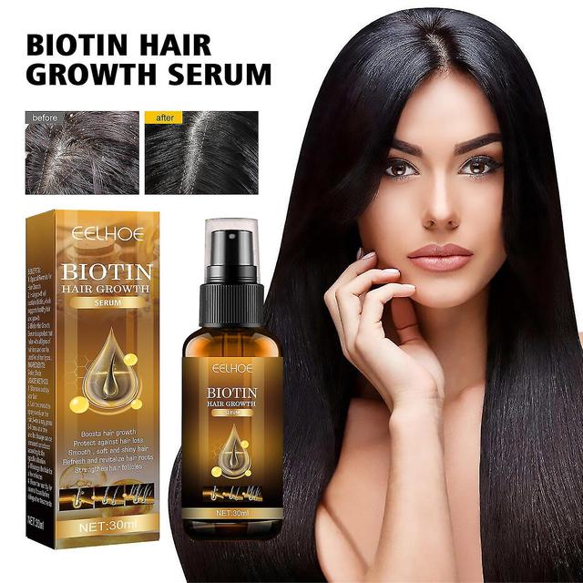 Hair Growth Products, Biotin, Fast Growing Hair Care, Essential Oil, Hair Loss Spray, Skin Nursing, 30ml on Productcaster.