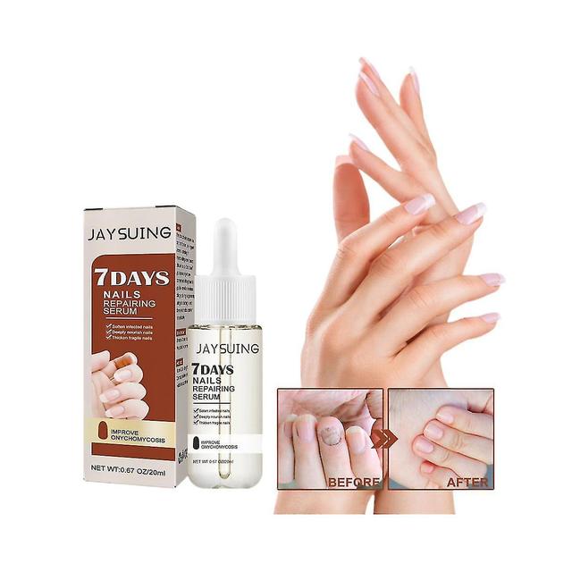 7 Tage Nagelwachstum Und Kräftigung Serum, Nagelwachstum Und Stärke Serum Nagelreparatur Neu on Productcaster.