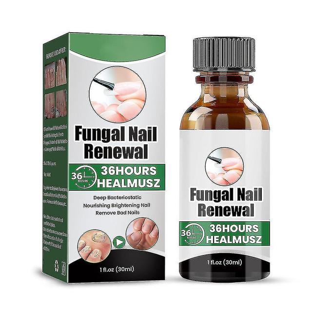 Toenail Onychomycosis Treatments Liquid Gental Natural Ingredients Anti-nail Onychomycosis Liquid Fo on Productcaster.