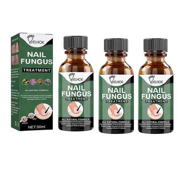 Onychomycosis korjausneste paksuuntunut kirkas kynsi pehmeä kynsineste jalkahoito neste onychomycosis manikyyri hoitoneste 50ml 3PCS on Productcaster.