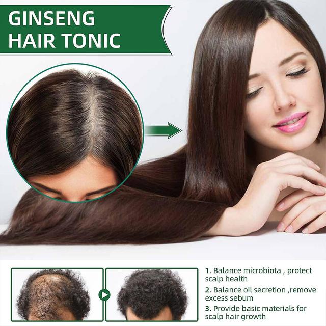 Luckitems Ginseng Germinal Essence Oil Spray Balance Microbiota Protect Scalp Health Spray for Dry Damaged Hai on Productcaster.