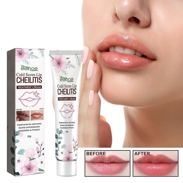 Crema para herpes labial y queilitis, nutre eficazmente los labios y los usa regularmente para tener labios hermosos on Productcaster.