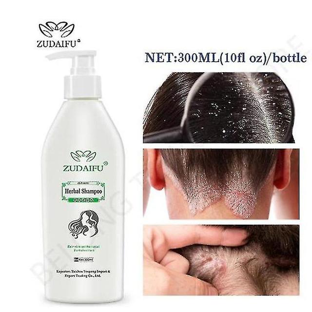 Hair Psoriasis Seborrheic Skin Care Treatment Dermatitis Eczema Compound Herbal 300ml on Productcaster.