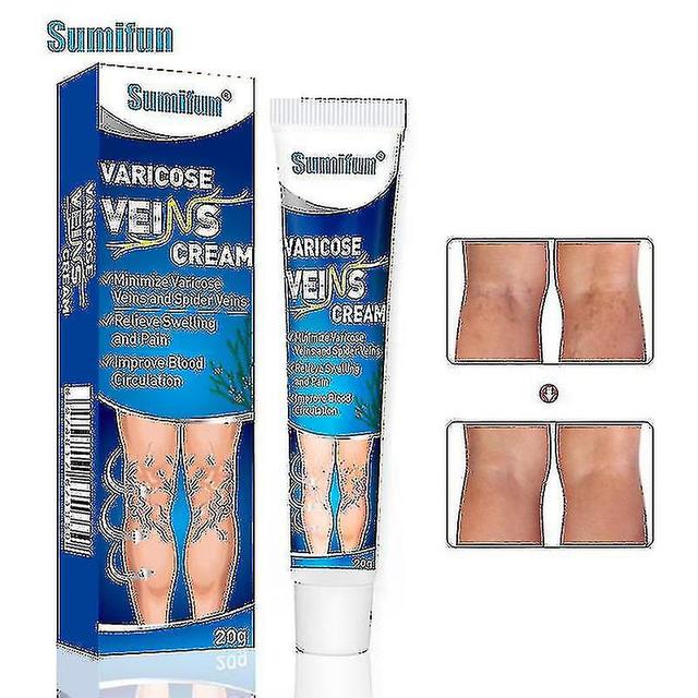 Varicose Veins Cream Eliminate Varicose Veins And Spider Veins,improve Blood Circulation Soothing Leg Cream2pcs Hk on Productcaster.