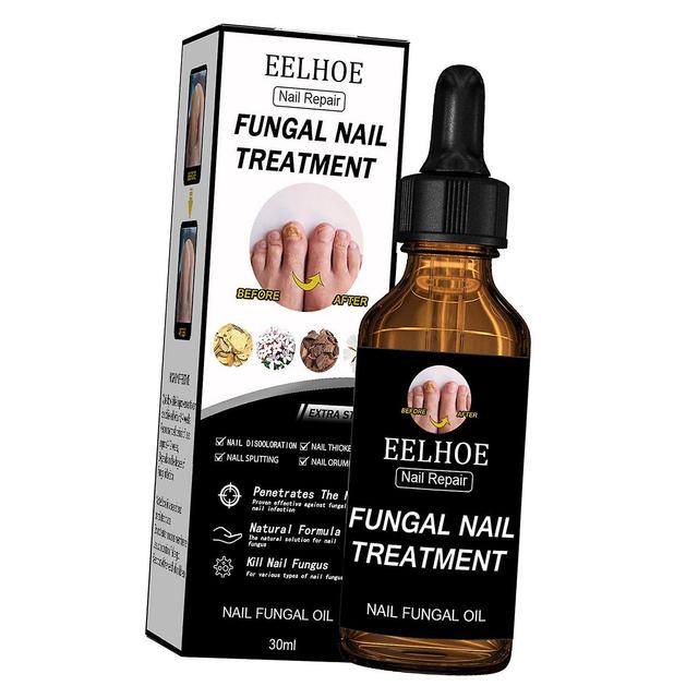 Nail Renewal Liquid For Discolored And Damaged Nails Multifunction Nail Gel 1 Bottle 30ml on Productcaster.