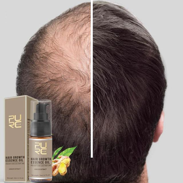 Congjing Hair Growth Essence Advanced Thinning Hair & Hair Loss Supplement 20ML on Productcaster.