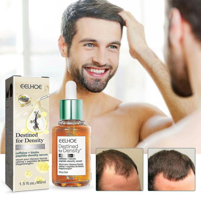 Hair Growth Essential Oil Fixing Anti-loss And Density Increasing Care Soft_Jan 2Pcs on Productcaster.