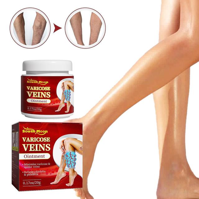 Shihaodian South Moon Leg Vein Repair Cream Varicose Massage Earthworm Leg Repair Blood Circulation Swelling Vitality on Productcaster.