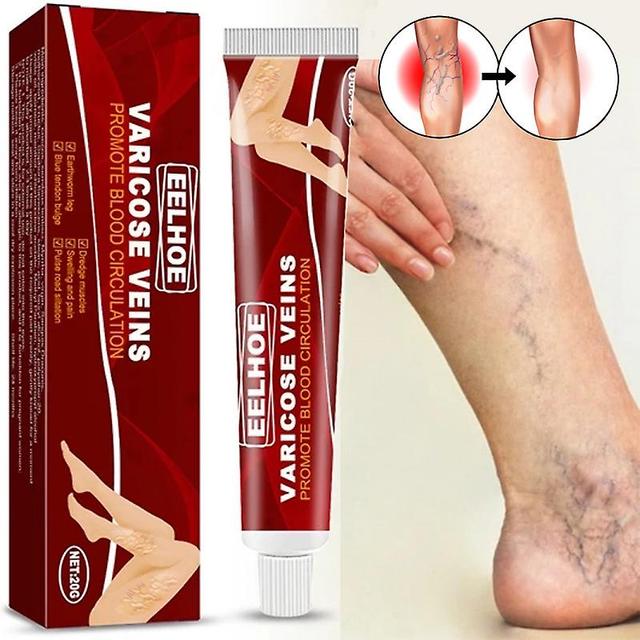 Face Herbs Cream For Varicose Veins, Vasculitis Of The Legs, Phlebitis, Spider, Institutes, Ointment, Plaster With Herbs, Beauty, Body, Healthcare on Productcaster.