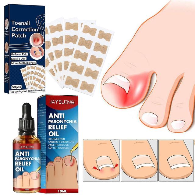 50pcs Nail Correction Stickers+10ml Anti Paronychia Relief Oil, Ingrown Toenail Treatment, Nail Renewal Liquid For Damaged Discoloration Nail on Productcaster.