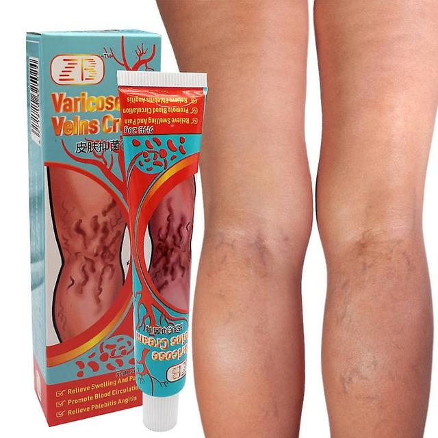 Qian Varicose Vein Ointment Remove Red Blood Streaks Varicosity Veins Angiitis Medical Plaster Vasculitis Phlebitis Spider Cream on Productcaster.