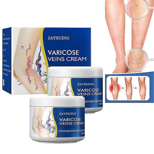 Jiuhaodian Jaysuing Leg Vein Repair Cream Pain Swelling Activating Collaterals Qu Zhang 2pcs on Productcaster.