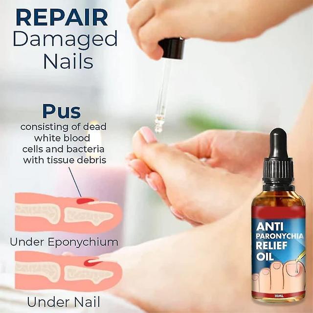 Anti Paronychia Relief Oil, Nail Helper Ingrowth Toenail Correction Treatment Oil, Anti Paronychia Relief Oil, Ingrown Toenail Drops, Repair And Im... on Productcaster.