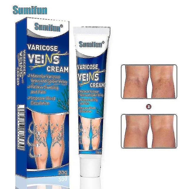 Varicose Veins Cream Eliminate Varicose Veins And Spider Veins,improve Blood Circulation Soothing Leg Cream2pcs on Productcaster.