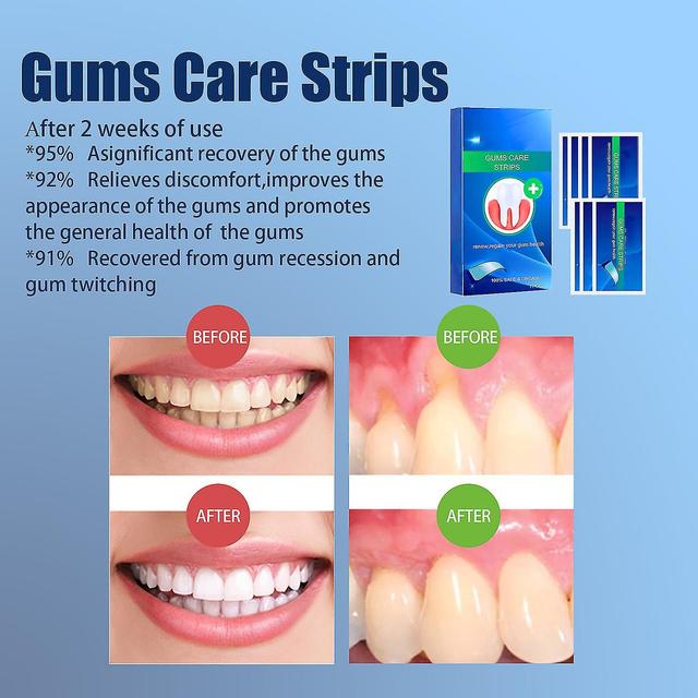 Gum reparation strimler, tyggegummi behandling for vigende tandkød, lindre tyggegummi brand, hævelse, smerte, tandpine, ubehag 2packs-14 par on Productcaster.