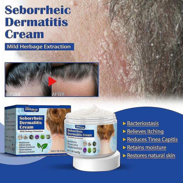 Exwo Seborrheic Skin Cream Head Acne Pruritus Scalp Ringworm Skin Problem Repair on Productcaster.