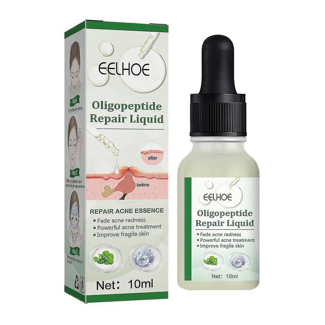 Qian Eelhoe Oligopeptide Repairing And Cleansing Liquid on Productcaster.