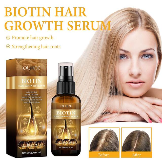 Gaoguang Hair Growth Product Biotin Fast Growing Hair Essential Oil Hair Loss Spray Skin Nursing 30ml 241098 Multicolor on Productcaster.