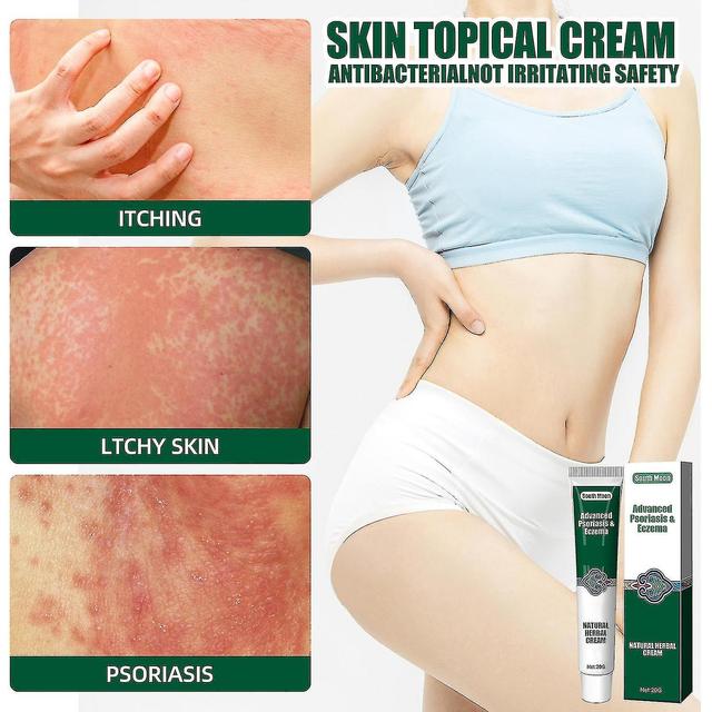 Herbal Ointment Perfect for Eczema Dermatitis Psoriasis Treatment Cream External Use on Productcaster.