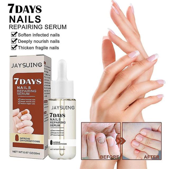 Zero Shipping Costs 4pcs Gfouk 7 Days Nail Growth And Strengthening Serum, Nail Growth And Strength Serum on Productcaster.