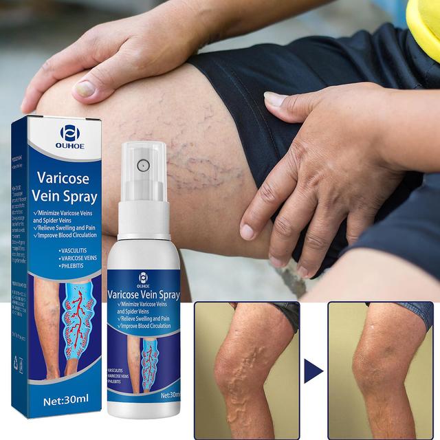 Relieve Vein Care Varicose Blood Vessel Bulging Pain Vein Massage Care Spray on Productcaster.