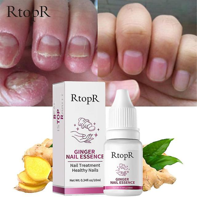 Lgigi 3pcs Ginger Nail Essence Antibacterial Kill Fungus Repair Essential Oil -10ml on Productcaster.