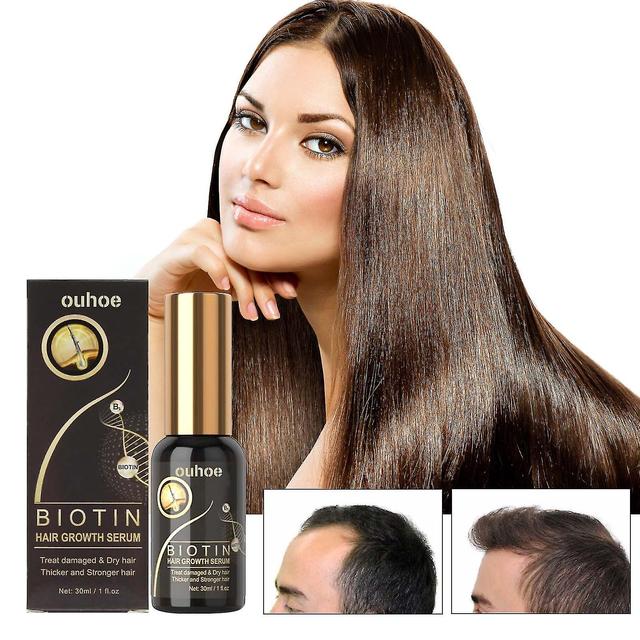 Hair Growth Products, Biotin, Fast Growing Hair Care, Essential Oil, Hair Loss Spray, Skin Nursing, 30ml on Productcaster.