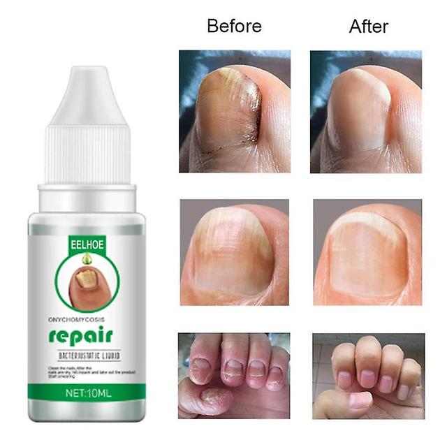 Nails Repair Essence Liquid Nail Renewal Liquid Solution Repair Strengthen 30ml on Productcaster.