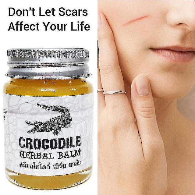 Crocodile Scars Elimination Cream, Thai Plant Balm, Whitening Of Acne Brands, Qualified Ration Of Scars, Controlled Pigmentation, Cre Q6c4 on Productcaster.