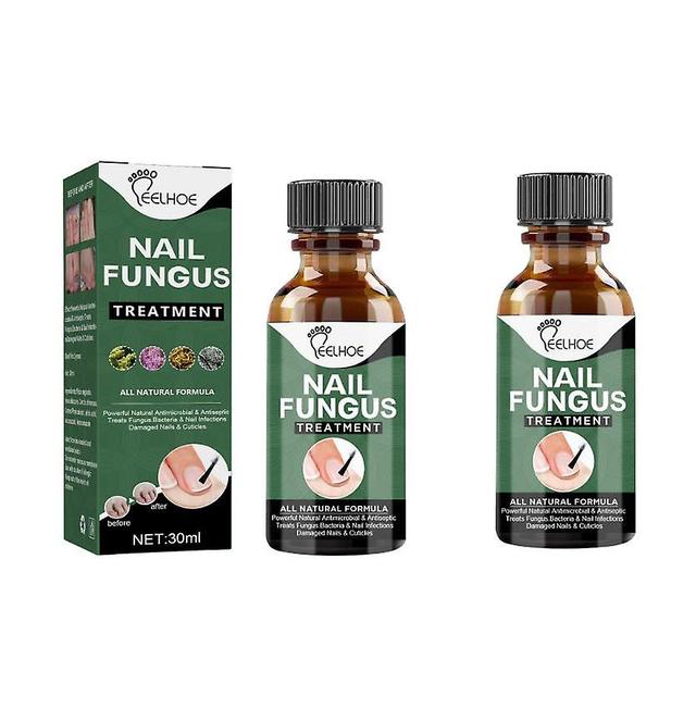 Onychomycosis Repair Liquid Thickened Bright Nail Soft Nail Liquid Foot Care Liquid Onychomycosis Manicure Care Liquid 30ml 2PCS on Productcaster.