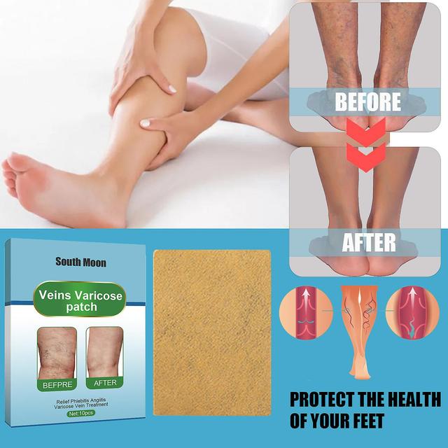 South Moon Leg Vein Care Patch Relaxing and Revitalizing Patch Muscle and Bone Leg Massage Care Patch Leg vein patch10pcs per box on Productcaster.