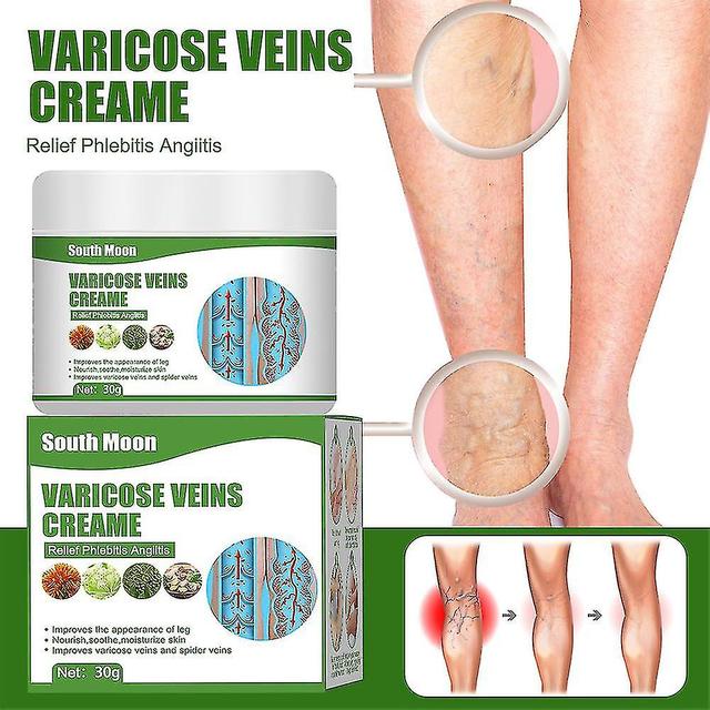 Cremevital Varicose Vein Creamcremevital Varicose Veins Cream,varicose Vein Cream For Legs,eliminate Varicose Veins And Spider Veins,relieve Pain on Productcaster.