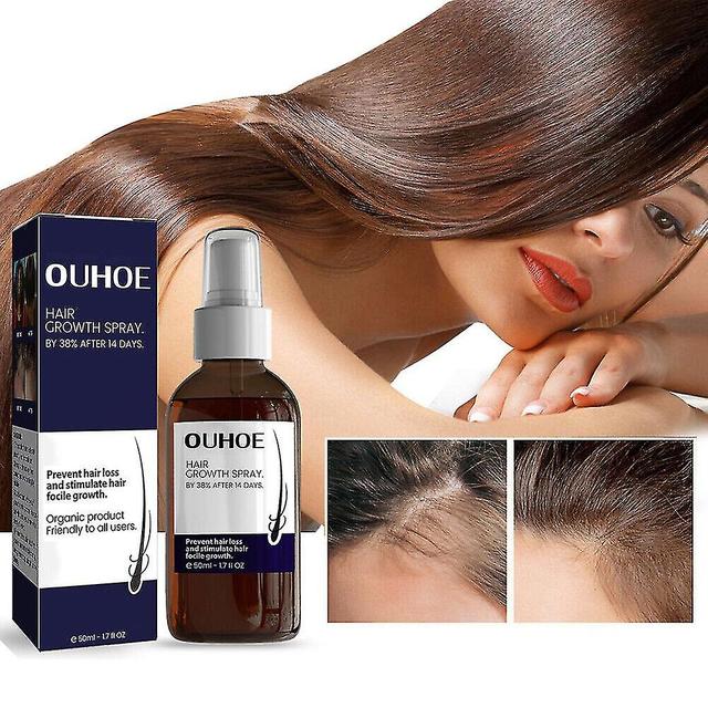 50ml Blusoms Hairgrowth Formula Serum Spray, Ashwagandha 4500 Hair Growth Spray on Productcaster.