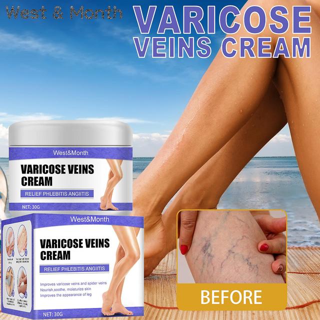 Vein repair cream, leg varicose veins, bulging leg veins, pain, Maikang leg care vein cream Vein Repair Cream30g on Productcaster.