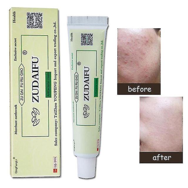 Buy 1 Get 1 Freepsoriasis Eczema Ointment Dermatitis Eczema Pruritus Treatment Skin Rash Disease Antibacterial Cream on Productcaster.