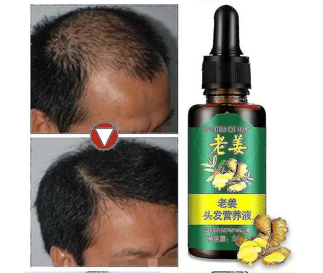 Duruimi 1pcs Ginger Germinal Oil Hair Nutrient Solution Hair Growth Essence Liquid on Productcaster.