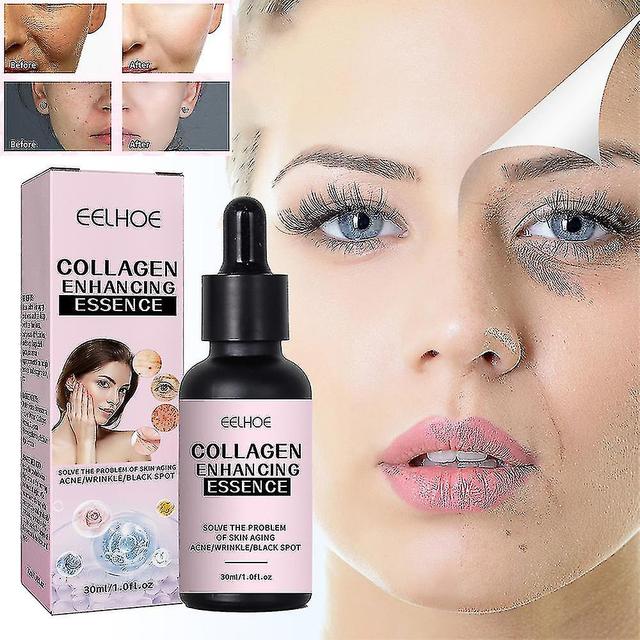 30ml Collagen Enhancement Essenza lentiggine sbiancante Rimuovere Tangrui 1Pc on Productcaster.