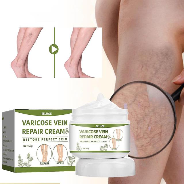 Th000 2023 New Eelhoe Varicose Vein Repair Cream Tongmai Relieves Leg Varicose Vein Pain Relief Earthworm Leg Pain Red Blood Silk Spider Leg Chang ... on Productcaster.