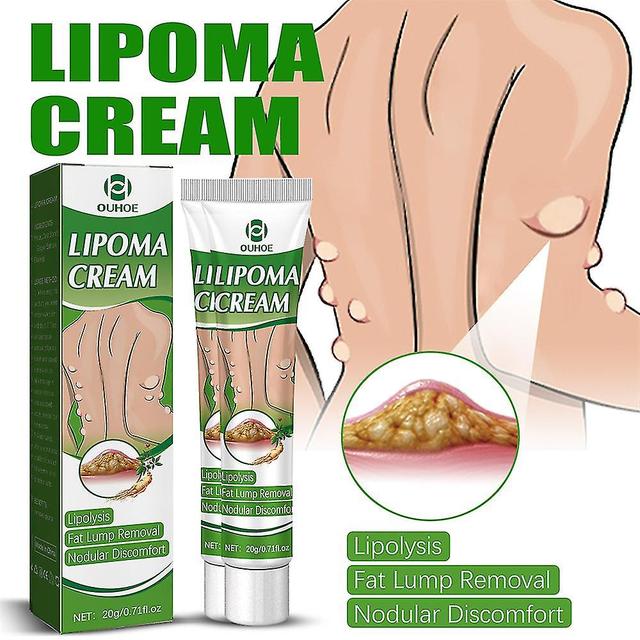 20g Lipoma Removal Cream Lipolysis Fat Lump Relief Plaster Skin Swelling Fat Elimination Cream Health Care -GSL on Productcaster.