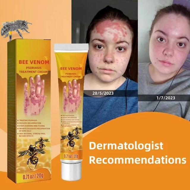 Weijianuo Uuden-Seelannin mehiläismyrkky Professional Care Gel, Uuden-Seelannin Bee Venom Joint Relief Gel, kermageeli luun ja nivelten hoitoon-w6 ... on Productcaster.