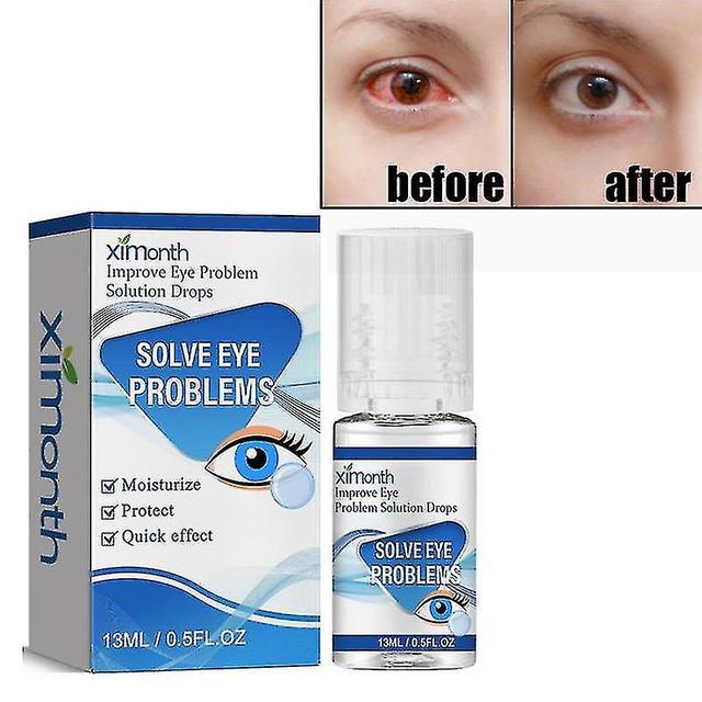 Chicoque Relieves Eye Fatigue Eyedrops on Productcaster.