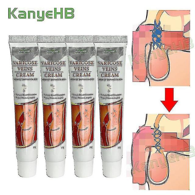 4pcs Varicose Cream Scrotum Varicocele Vein Vasculitis Plaster Varicosity Ointmenta642 on Productcaster.