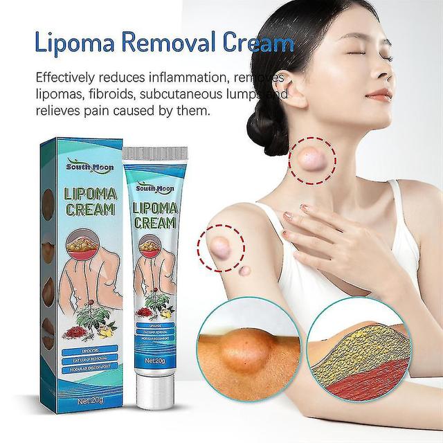 High-quality 2x New Lipoma Removal Cream Lipoma Treat Skin Swelling Delipidation Cream on Productcaster.