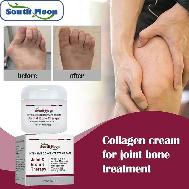 Wxgkv 30g Collagen Cream For Joints Relief Of Joint Bone Soreness And Deformity Correction And Repair on Productcaster.