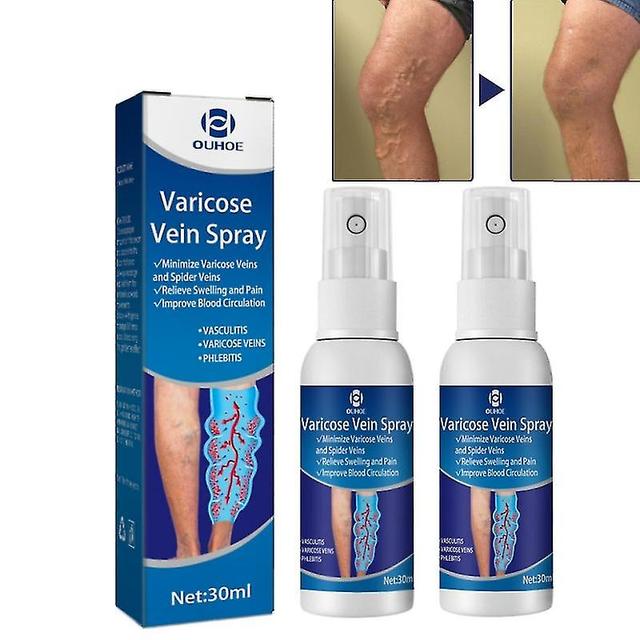 2pcs Spray For Varicose Veins Effective Varicose Vein Relief Cream To Relieve Leg Vasculitis Phlebitis Spider Pain Swelling Body Care on Productcaster.