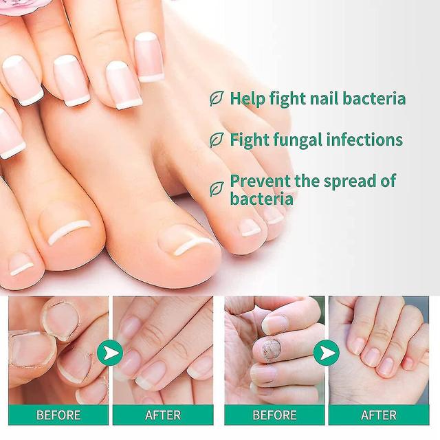 Kerassentials Toenail Fungus Treatment, Kerassentials Healthy Skin Hair Nails Kerassentials For Toenail Fungus A 2pcs on Productcaster.